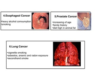 4.Esophageal Cancer heavy alcohol comsumption smoking 5.Prostate Cancer increasing of age family history diet high in animal fat 6.Lung Cancer cigarette smoking asbestos, arsenic and radon exposure secondhand smoke 