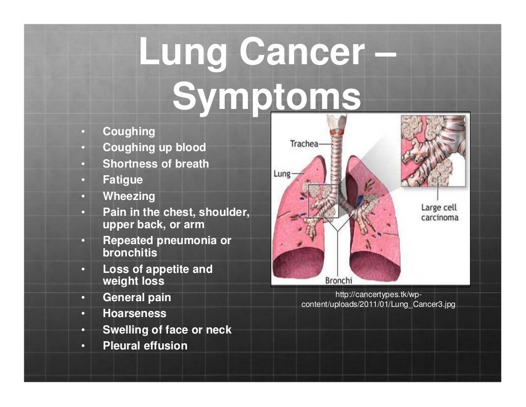 cancer