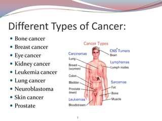 Types S Cancer Cancer | PPTX