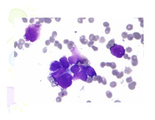 • Till this time – no one had
actually seen cancer cells!!!

 