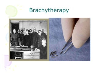 Brachytherapy

 