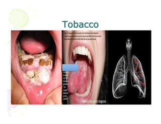 Tobacco

 