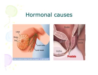 Hormonal causes

 