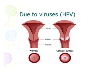 Due to viruses (HPV)

 