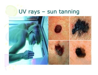 UV rays – sun tanning

 
