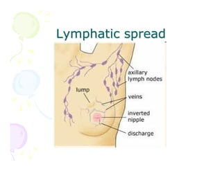Lymphatic spread

 