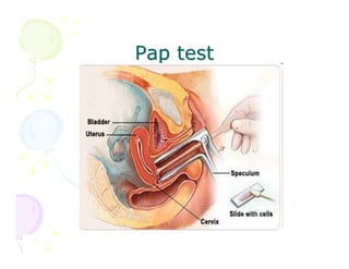 Pap test

 