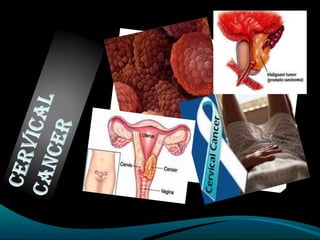 WHAT IS CERVICAL CANCER?
A woman should have an annual check-up with a doctor
or clinic nurse to check for cervical cance...