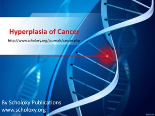 Hyperplasia of Cancer 
http://www.scholoxy.org/journals/cancer.php 
By Scholoxy Publications 
www.scholoxy.org 
 