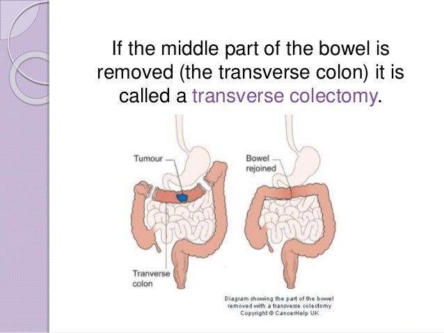 Cancer (Diet therapy, Nutritional care)