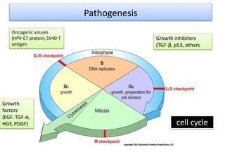 Pathogenesis
cell cycle
Growth inhibitors
(TGF-β, p53, others
Oncogenic viruses
(HPV-E7 protein; SV40-T
antigen
Growth
factors
(EGF. TGF-α,
HGF, PDGF)
 