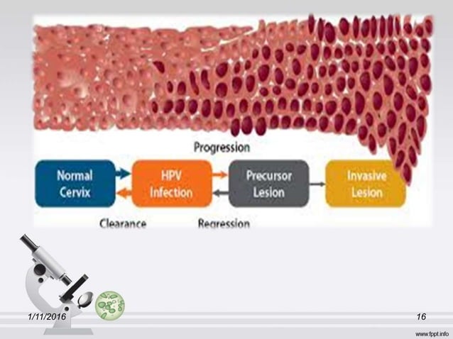 умайн хүзүүний хорт хавдар | PPT
