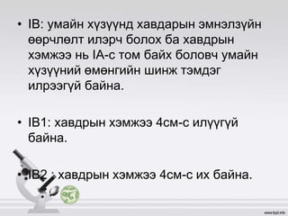 • IB: умайн хүзүүнд хавдарын эмнэлзүйн
өөрчлөлт илэрч болох ба хавдрын
хэмжээ нь IA-с том байх боловч умайн
хүзүүний өмөнгийн шинж тэмдэг
илрээгүй байна.
• IB1: хавдрын хэмжээ 4см-с илүүгүй
байна.
• IB2 : хавдрын хэмжээ 4см-с их байна.
 