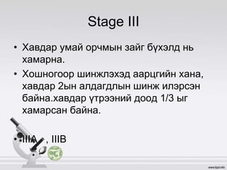 Stage III
• Хавдар умай орчмын зайг бүхэлд нь
хамарна.
• Хошногоор шинжлэхэд аарцгийн хана,
хавдар 2ын алдагдлын шинж илэрсэн
байна.хавдар үтрээний доод 1/3 ыг
хамарсан байна.
• IIIA , IIIB
 