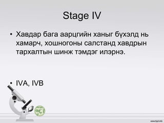 Stage IV
• Хавдар бага аарцгийн ханыг бүхэлд нь
хамарч, хошногоны салстанд хавдрын
тархалтын шинж тэмдэг илэрнэ.
• IVA, IVB
 