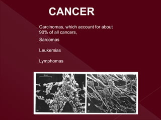 CANCER
Sarcomas
Leukemias
Lymphomas
Carcinomas, which account for about
90% of all cancers,
 