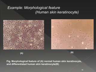 Example: Morphological feature
(Human skin keratinocyte)
(A) (B)
Fig. Morphological feature of (A) normal human skin keratinocyte,
and differentiated human skin keratinocyte(B).
18
 