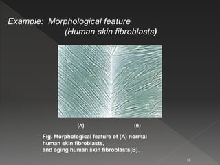 Example: Morphological feature
(Human skin fibroblasts)
(A) (B)
Fig. Morphological feature of (A) normal
human skin fibroblasts,
and aging human skin fibroblasts(B).
19
 