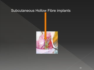 Subcutaneous Hollow Fibre implants
33
 