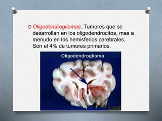 O Oligodendrogliomas: Tumores que se
desarrollan en los oligodendrocitos, mas a
menudo en los hemisferios cerebrales.
Son el 4% de tumores primarios.
 