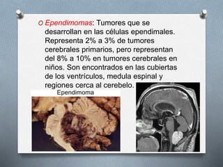 O Ependimomas: Tumores que se
desarrollan en las células ependimales.
Representa 2% a 3% de tumores
cerebrales primarios, pero representan
del 8% a 10% en tumores cerebrales en
niños. Son encontrados en las cubiertas
de los ventrículos, medula espinal y
regiones cerca al cerebelo.
 