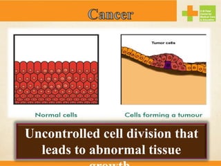 Uncontrolled cell division that
leads to abnormal tissue
 