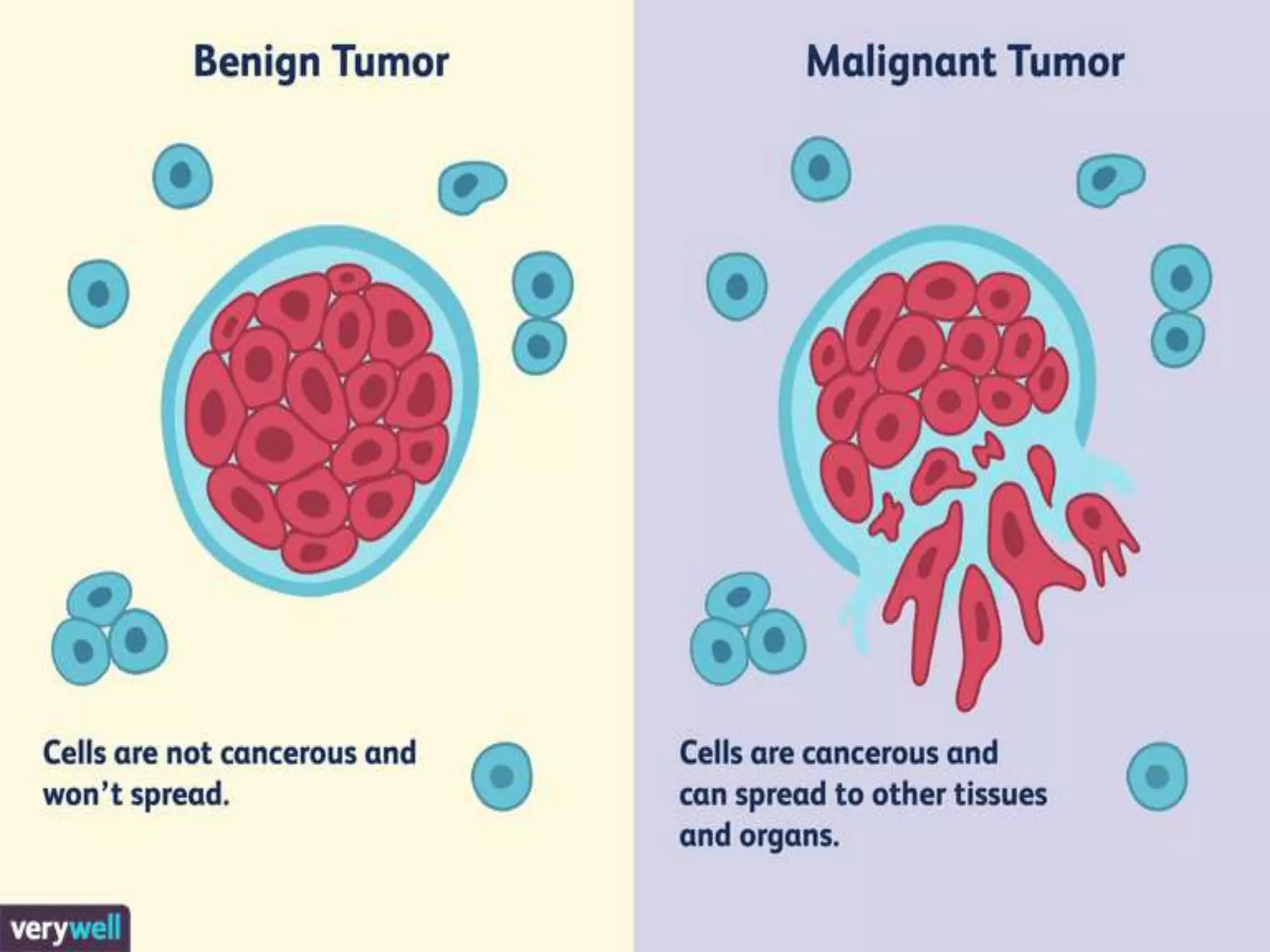 Cancer - Types ,spread and properties | PPTX