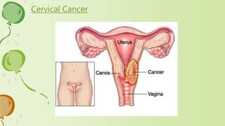 Cervical Cancer
 