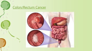 Colon/Rectum Cancer
 