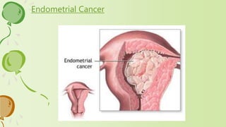 Endometrial Cancer
 
