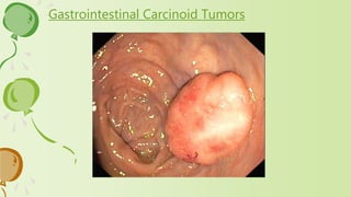 Gastrointestinal Carcinoid Tumors
 
