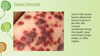 Kaposi Sarcoma
cancer that causes
lesions (abnormal
tissue) to grow in
the skin; the
mucous
membranes lining
the mouth, nose,
and throat; lymph
nodes; or other
organs.
 