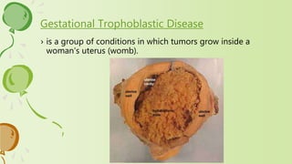 › is a group of conditions in which tumors grow inside a
woman's uterus (womb).
Gestational Trophoblastic Disease
 