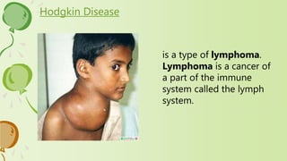 Hodgkin Disease
is a type of lymphoma.
Lymphoma is a cancer of
a part of the immune
system called the lymph
system.
 