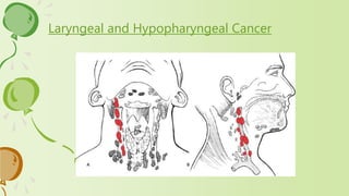 Laryngeal and Hypopharyngeal Cancer
 