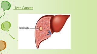 Liver Cancer
 
