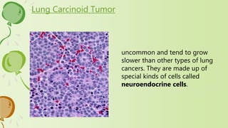 Lung Carcinoid Tumor
uncommon and tend to grow
slower than other types of lung
cancers. They are made up of
special kinds of cells called
neuroendocrine cells.
 