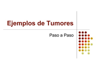 Ejemplos de Tumores
Paso a Paso
 