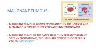 MALIGNANT TUMOUR-
• MALIGNANT TUMOUR GROWS FASTER AND THEY ARE INVASIVE AND
METASTATIC IN NATURE. THESE CELLS ARE UNDIFFERENTIATED.
• MALIGNANT TUMOURS ARE CANCEROUS. THEY SPREAD TO DISTANT
SITES via BLOODSTREAM, THE LYMPHATIC SYSTEM. THIS SPREAD IS
CALLED “METASTASIS”.
 