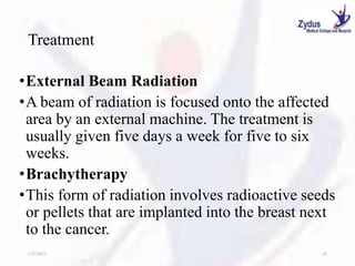 Treatment
•External Beam Radiation
•A beam of radiation is focused onto the affected
area by an external machine. The treatment is
usually given five days a week for five to six
weeks.
•Brachytherapy
•This form of radiation involves radioactive seeds
or pellets that are implanted into the breast next
to the cancer.
1/27/2023 43
 