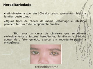 Hereditariedade
•retinoblastoma que, em 10% dos casos, apresentam história
familiar deste tumor.
•Alguns tipos de câncer de mama, estômago e intestino
parecem ter um forte componente familiar.
São raros os casos de cânceres que se devem
exclusivamente a fatores hereditários, familiares e étnicos,
apesar de o fator genético exercer um importante papel na
oncogênese.
retinoblastoma
 
