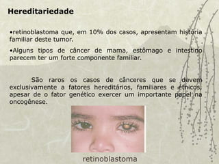 Hereditariedade
•retinoblastoma que, em 10% dos casos, apresentam história
familiar deste tumor.
•Alguns tipos de câncer de mama, estômago e intestino
parecem ter um forte componente familiar.
São raros os casos de cânceres que se devem
exclusivamente a fatores hereditários, familiares e étnicos,
apesar de o fator genético exercer um importante papel na
oncogênese.
retinoblastoma
 