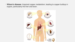 • Wilson's disease: Impaired copper metabolism, leading to copper buildup in
organs, particularly the liver and brain.
 