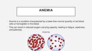 ANEMIA
• Anemia is a condition characterized by a lower-than-normal quantity of red blood
cells or hemoglobin in the blood.
• This can result in reduced oxygen-carrying capacity, leading to fatigue, weakness,
and paleness.
 