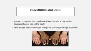 HEMOCHROMATOSIS
• Hemochromatosis is a condition where there is an excessive
accumulation of iron in the body.
• This excess iron can deposit in organs, causing damage over time.
 