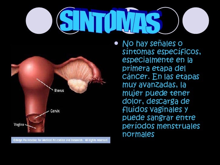 Cancer Cervical