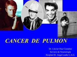CANCER  DE  PULMON   Dr. J.Javier Diaz Castañon Servicio de Neumología Hospital Dr. Angel Leaño U.A.G. 