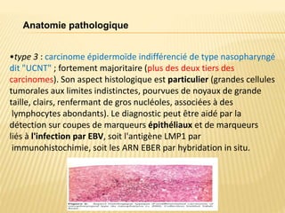 •type 3 : carcinome épidermoïde indifférencié de type nasopharyngé
dit "UCNT" ; fortement majoritaire (plus des deux tiers des
carcinomes). Son aspect histologique est particulier (grandes cellules
tumorales aux limites indistinctes, pourvues de noyaux de grande
taille, clairs, renfermant de gros nucléoles, associées à des
lymphocytes abondants). Le diagnostic peut être aidé par la
détection sur coupes de marqueurs épithéliaux et de marqueurs
liés à l'infection par EBV, soit l'antigène LMP1 par
immunohistochimie, soit les ARN EBER par hybridation in situ.
Anatomie pathologique
 