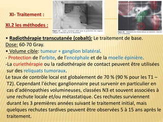 XI.2 les méthodes :
• Radiothérapie transcutanée (cobalt): Le traitement de base.
Dose: 60-70 Gray.
• Volume cible: tumeur + ganglion bilatéral.
- Protection de l’orbite, de l’encéphale et de la moelle épinière.
-La curiethérapie ou la radiothérapie de contact peuvent être utilisées
sur des reliquats tumoraux.
Le taux de contrôle local est globalement de 70 % (90 % pour les T1 –
T2). Cependant l'échec ganglionnaire peut survenir en particulier en
cas d'adénopathies volumineuses, classées N3 et souvent associées à
une rechute locale et/ou métastatique. Ces rechutes surviennent
durant les 3 premières années suivant le traitement initial, mais
quelques rechutes tardives peuvent être observées 5 à 15 ans après le
traitement.
XI- Traitement :
 