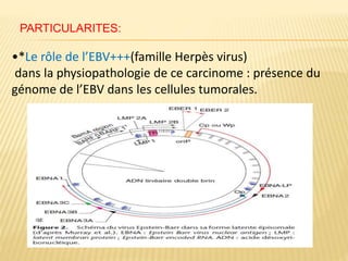 •*Le rôle de l’EBV+++(famille Herpès virus)
dans la physiopathologie de ce carcinome : présence du
génome de l’EBV dans les cellules tumorales.
PARTICULARITES:
 